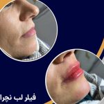 مرکز زیبایی دکتر حسین رحمانی در زنجان