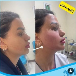 کلینیک زیبایی مهرینا در شهر قدس