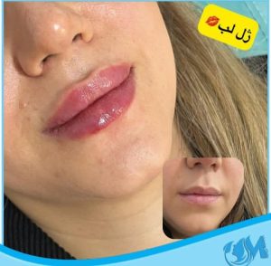 کلینیک زیبایی مهرینا در شهر قدس