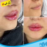 کلینیک زیبایی مهرینا در شهر قدس