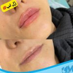 کلینیک زیبایی مهرینا در شهر قدس