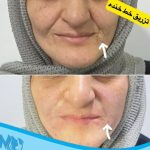 کلینیک زیبایی مهرینا در شهر قدس