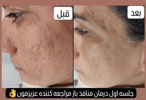 موسسه زیبایی شیرین صفوی در جیرفت 