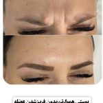 کلینیک زیبایی مهرسام در همدان