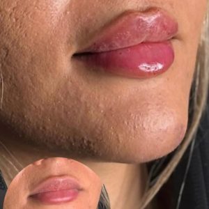 کلینیک زیبایی مهرسام در همدان