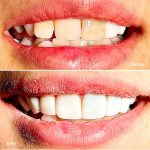 مطب دندانپزشکی تمام دیجیتال دکتر سید مرتضی میر محمدی در یزد