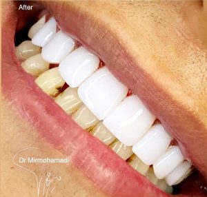 مطب دندانپزشکی تمام دیجیتال دکتر سید مرتضی میر محمدی در یزد