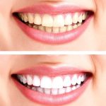 مطب دندانپزشکی تمام دیجیتال دکتر سید مرتضی میر محمدی در یزد