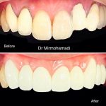 مطب دندانپزشکی تمام دیجیتال دکتر سید مرتضی میر محمدی در یزد