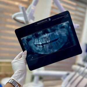 مطب دندانپزشکی دکتر شمیم مولایی در جیرفت