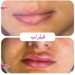 کلینیک زیبایی آرتیسا در سبزوار