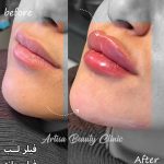 کلینیک زیبایی آرتیسا در سبزوار