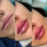 کلینیک زیبایی آرتیسا در سبزوار