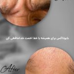 کلینیک زیبایی آرتیسا در سبزوار