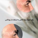 کلینیک زیبایی آرتیسا در سبزوار