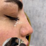 مرکز تخصصی ژل و بوتاکس رز نیو فیس در نسیم شهر