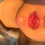 مرکز ژل و بوتاکس دکتر علی ابراهیمی در قم
