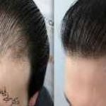 جراح و متخصص پوست و مو و زیبایی دکتر آرزو پاشائی در تنکابن