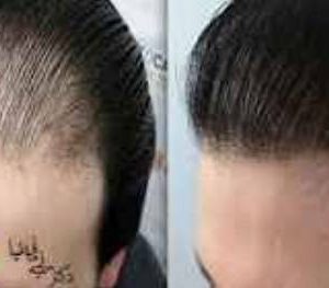 جراح و متخصص پوست و مو و زیبایی دکتر آرزو پاشائی در تنکابن