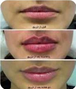 جراح و متخصص پوست و مو و زیبایی دکتر آرزو پاشائی در تنکابن