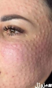 کلینیک فیلر بادی و فول فیس نادینا در کرج