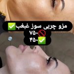 کلینیک فیلر بادی و فول فیس نادینا در کرج