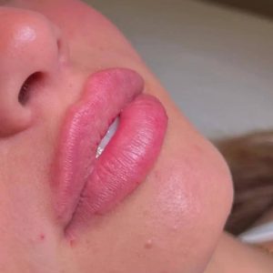 کلینیک فیلر بادی و فول فیس نادینا در کرج