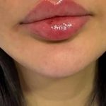 مرکز ژل و بوتاکس دکتر علی ابراهیمی در قم