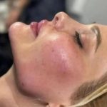 مرکز تخصصی ژل و بوتاکس رز نیو فیس در نسیم شهر