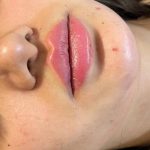 مرکز ژل و بوتاکس دکتر علی ابراهیمی در قم