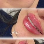 مرکز تخصصی ژل و بوتاکس رز نیو فیس در نسیم شهر