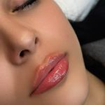 مرکز تخصصی ژل و بوتاکس رز نیو فیس در نسیم شهر