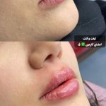 مرکز ژل و بوتاکس دکتر علی ابراهیمی در قم