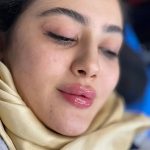 مرکز ژل و بوتاکس دکتر علی ابراهیمی در قم