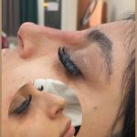 مرکز تخصصی ژل و بوتاکس رز نیو فیس در نسیم شهر