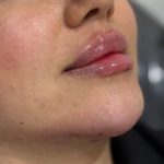 کلینیک زیبایی پوست و مو گاش در نازی آباد تهران