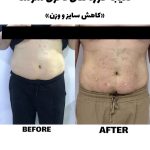 مرکز زیبایی و لاغری سوشا در اهواز