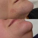 کلینیک زیبایی فیروزه در ارومیه