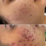 خدمات تخصصی فشیال مریم کشاورز در شیراز