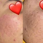 خدمات تخصصی فشیال مریم کشاورز در شیراز