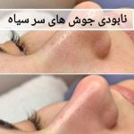 خدمات تخصصی فشیال مریم کشاورز در شیراز