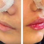مطب زیبایی دکتر انوشه محمودیان در بلوار سجاد مشهد