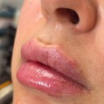مطب زیبایی دکتر انوشه محمودیان در بلوار سجاد مشهد