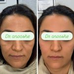 مطب زیبایی دکتر انوشه محمودیان در بلوار سجاد مشهد
