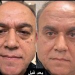مرکز زیبایی یوسف آباد در تهران