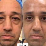 مرکز زیبایی یوسف آباد در تهران