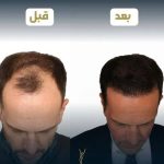 مرکز زیبایی یوسف آباد در تهران