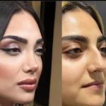 مرکز زیبایی یوسف آباد در تهران