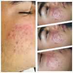 مرکز تخصصی فیشال طلائی در مهرشهر کرج