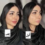 کلینیک زیبایی دنیا مهر در یافت آباد تهران